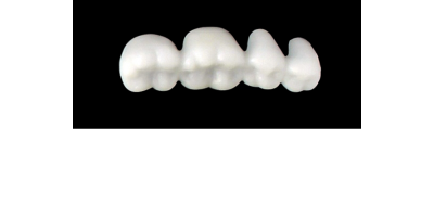 Cod.EXLOWER LEFT : 15x  posterior hollow wax veneers-bridges, X-LARGE, (34-37), with precarved occlusion to Cod.EXUPPER LEFT, and compatible to Cod.SXLOWER LEFT  (solid), (34-37)